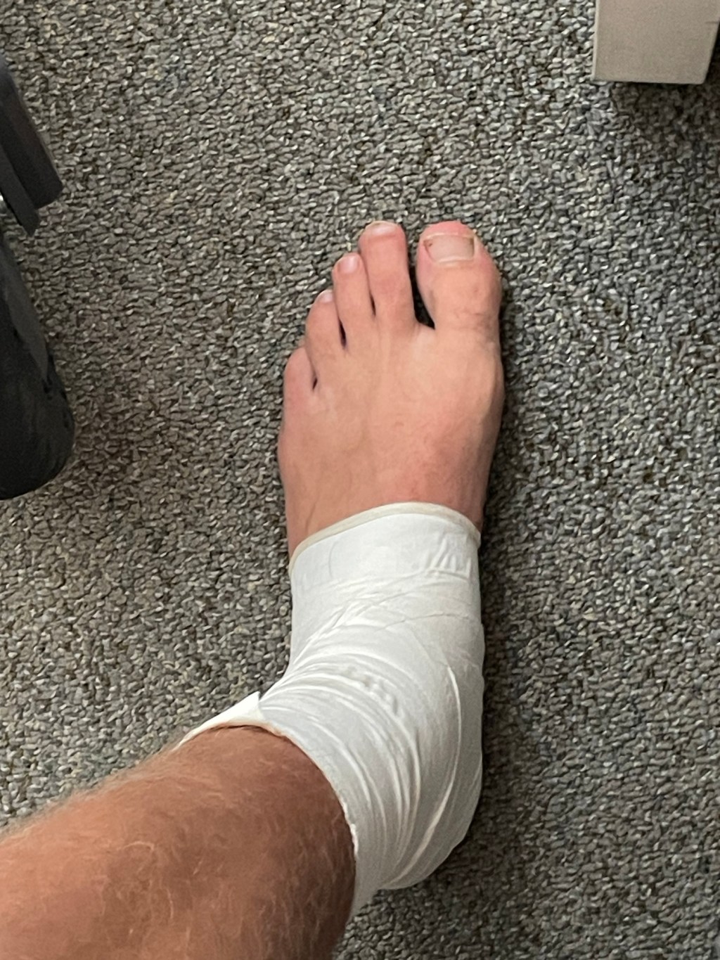 9/16/24 – Day 11 – Bullet Proof&nbsp;Ankle