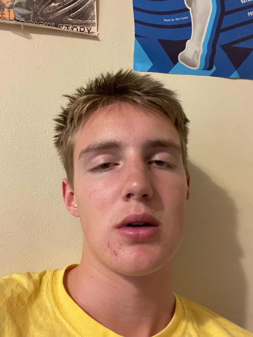3/15/25 – Day 74 – Sick Like a&nbsp;Dog